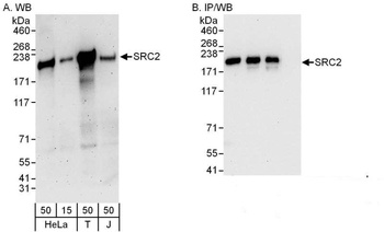 NCOA2/SRC2 Antibody