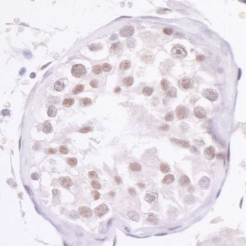 Rabbit anti-NCOA2/SRC2 Antibody