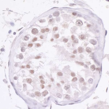 NCOA2/SRC2 Antibody