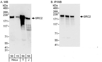 Rabbit anti-NCOA2/SRC2 Antibody