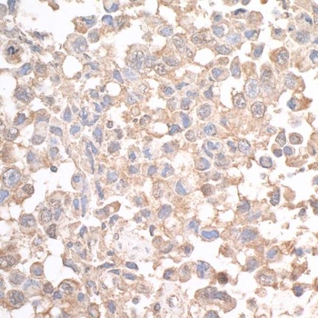 Rabbit anti-JLP Antibody