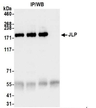 Rabbit anti-JLP Antibody