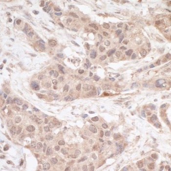 Rabbit anti-FHL2 Antibody