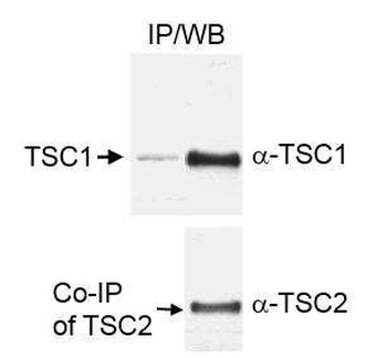 TSC1 Antibody