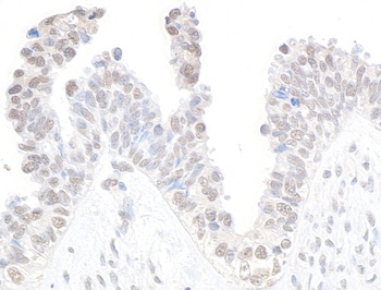 Rabbit anti-CDK11 Antibody