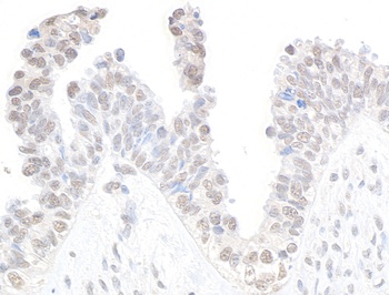 CDK11 Antibody