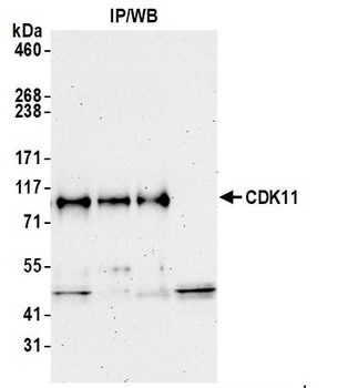 Rabbit anti-CDK11 Antibody