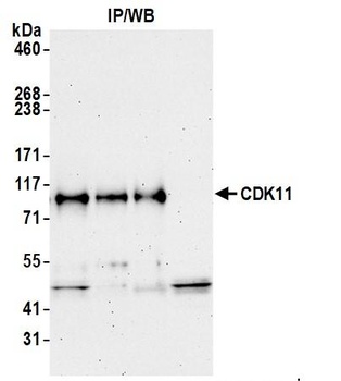 CDK11 Antibody