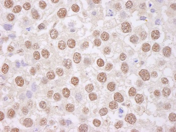 Rabbit TAFII68 Antibody