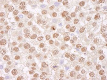 Rabbit TAFII68 Antibody