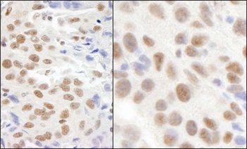 Rabbit anti-KIAA0082 Antibody