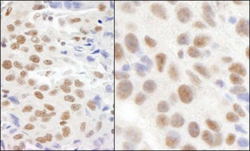 KIAA0082 Antibody