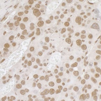 Rabbit anti-FUS Antibody