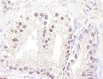 Rabbit ATM Antibody