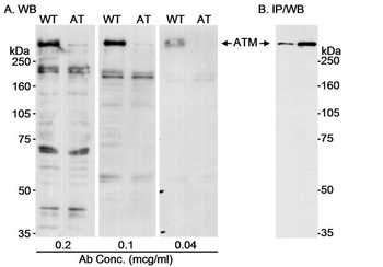 Rabbit ATM Antibody