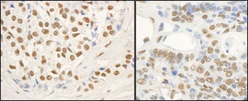 Rabbit anti-FUS Antibody