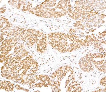 Rabbit anti-FUS Antibody