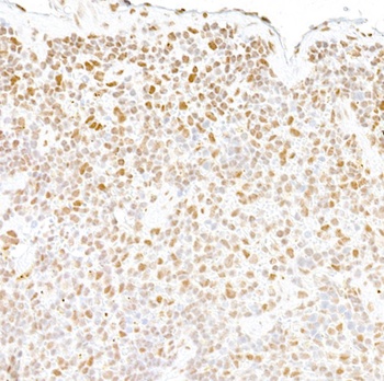 Rabbit anti-FUS Antibody