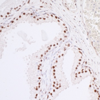Rabbit anti-Caper Antibody