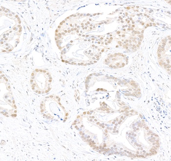 Rabbit anti-Caper Antibody