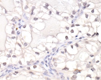 HIF1-alpha Antibody