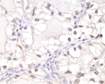 Rabbit anti-HIF1-alpha Antibody