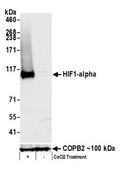 Rabbit anti-HIF1-alpha Antibody