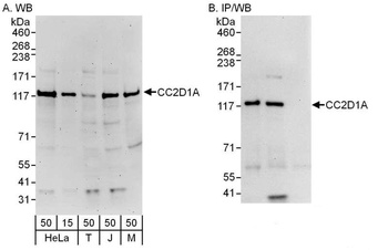 CC2D1A Antibody