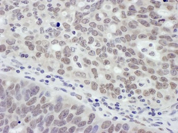 Rabbit anti-MTA1 Antibody