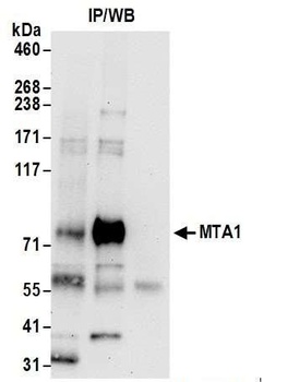 Rabbit anti-MTA1 Antibody