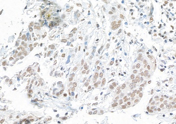Rabbit anti-SMAR1/BANP Antibody