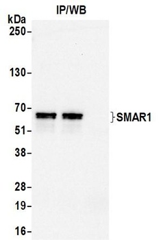 Rabbit anti-SMAR1/BANP Antibody
