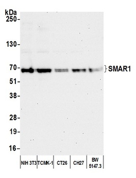 SMAR1/BANP Antibody