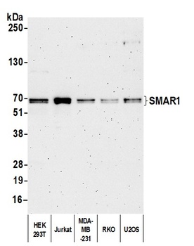 Rabbit anti-SMAR1/BANP Antibody