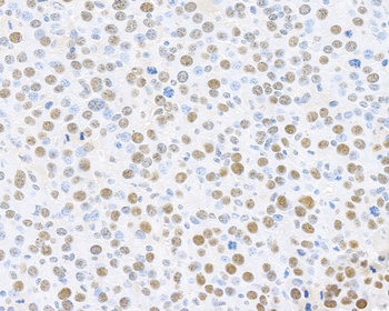 PCNA Antibody