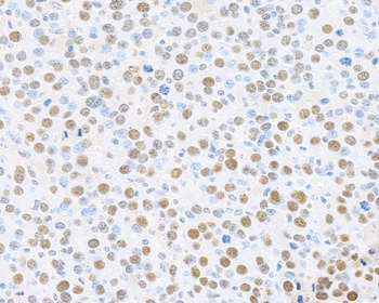 Rabbit anti-PCNA Antibody