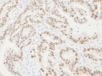 Rabbit anti-PCNA Antibody