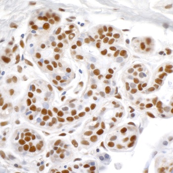 Rabbit KAP-1 Antibody