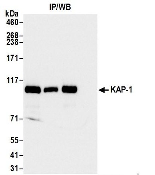 Rabbit KAP-1 Antibody