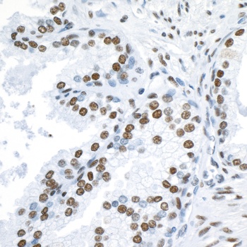 Rabbit anti-53BP1 Antibody