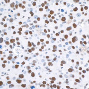 Rabbit anti-53BP1 Antibody