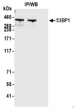 Rabbit anti-53BP1 Antibody