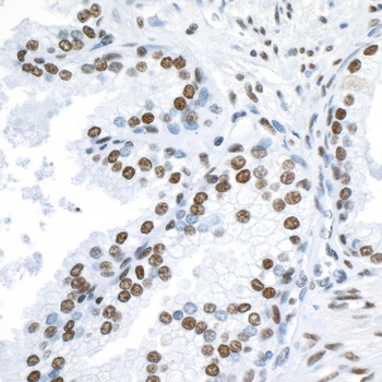 53BP1 Antibody