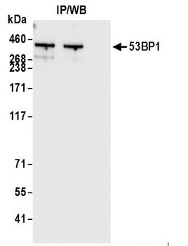 53BP1 Antibody