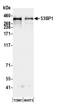 53BP1 Antibody