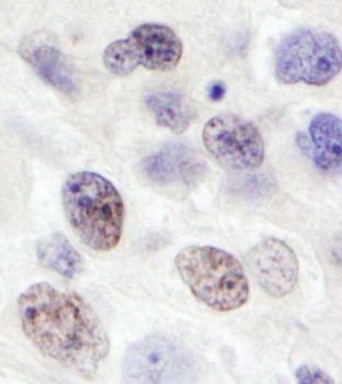 Rabbit anti-FLJ20530/KAONASHI1 Antibody
