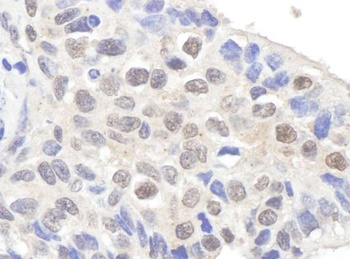 Rabbit anti-Claspin Antibody