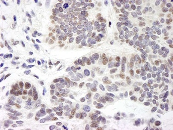 Rabbit ZNF261 Antibody