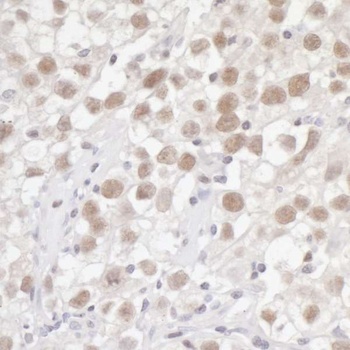 Rabbit Fen1 Antibody