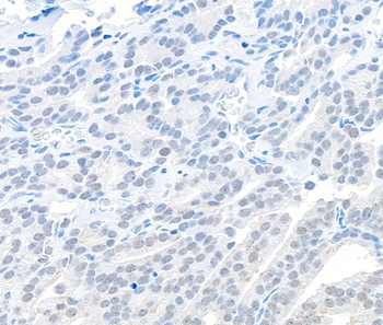 Rabbit anti-EMSY Antibody